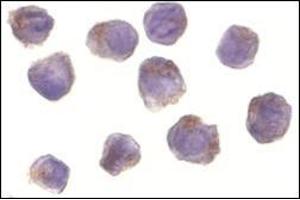 Immunocytochemistry of RICK in A431 cells with this product at 10 μg/ml. (RIPK2 抗体  (N-Term))