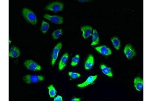 Immunofluorescent analysis of A549 cells using ABIN7170015 at dilution of 1:100 and Alexa Fluor 488-congugated AffiniPure Goat Anti-Rabbit IgG(H+L) (SLC5A2 抗体  (AA 335-422))