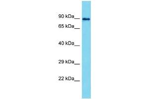 Host: Rabbit  Target Name: Mapk8ip2  Sample Tissue: Rat Testis lysates  Antibody Dilution: 1. (IB2 抗体  (Middle Region))