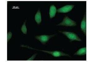 Immunostaining analysis in HeLa cells. (E2F5 抗体)