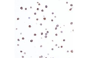 Immunocytochemistry (ICC) image for anti-HLA-DR-gamma (CD74) antibody (ABIN7449435) (CD74 抗体)