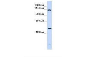 Image no. 1 for anti-ADAM Metallopeptidase with thrombospondin Type 1 Motif, 18 (ADAMTS18) (AA 144-193) antibody (ABIN6738844) (ADAMTS18 抗体  (AA 144-193))