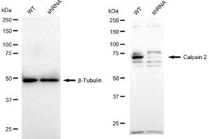 Western blotting analysis using Calpain 2 antibody (ABIN7797847). (Recombinant Calpain 2 抗体)