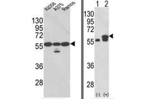 (LEFT) Western blot analysis of PDIA3 Antibody (Center) in A2058, A375, Ramos cell line lysates (35ug/lane). (PDIA3 抗体  (Middle Region))