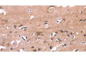 Immunohistochemistry (Paraffin-embedded Sections) (IHC (p)) image for anti-Phosphatidylinositol-4-Phosphate 5-Kinase, Type I, beta (PIP5K1B) antibody (ABIN7236220)