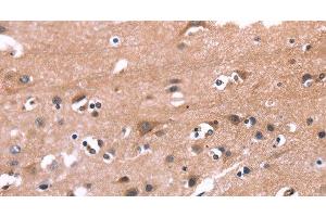 Immunohistochemistry of paraffin-embedded Human brain tissue using PIP5K1B Polyclonal Antibody at dilution 1:30 (PIP5K1B 抗体)