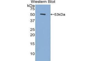 Detection of Recombinant FGB, Human using Polyclonal Antibody to Fibrinogen Beta Chain (FGB) (Fibrinogen beta Chain 抗体  (AA 45-491))