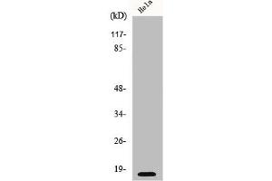 Western Blot analysis of HeLa cells using p16 Polyclonal Antibody (CDKN2A 抗体  (N-Term))