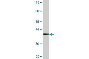 Western Blot detection against Immunogen (36. (SSH1 抗体  (AA 752-849))