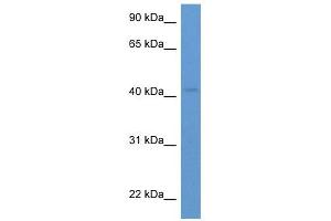 Western Blot showing HSH2D antibody used at a concentration of 1-2 ug/ml to detect its target protein. (HSH2D 抗体  (C-Term))