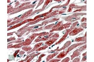Immunohistochemistry (IHC) image for anti-Prostaglandin-Endoperoxide Synthase 1 (Prostaglandin G/H Synthase and Cyclooxygenase) (PTGS1) (C-Term) antibody (ABIN184671)