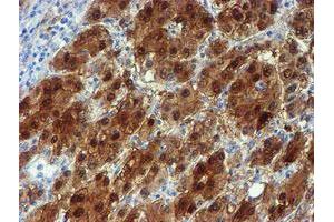 Image no. 3 for anti-NQO2 (NQO2) antibody (ABIN1499816) (NQO2 抗体)