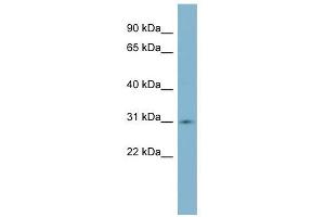 SCO1 antibody used at 1 ug/ml to detect target protein. (SCO1 抗体)