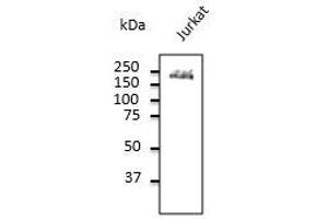 Endogenous CD45 detected with at 1/500 dilution, Iysate at 100 µg per Iane and rabbit polyclonal to goat lgG (HRP) at 1/10,000 dilution. (CD45 抗体  (C-Term))