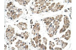 FKTN antibody was used for immunohistochemistry at a concentration of 4-8 ug/ml to stain Skeletal muscle cells (arrows) in Human Muscle. (Fukutin 抗体  (N-Term))