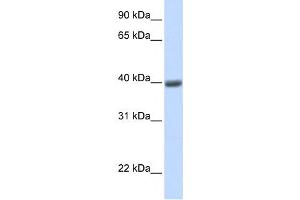 Western Blotting (WB) image for anti-Melanoma Antigen Family A, 1 (Directs Expression of Antigen MZ2-E) (MAGEA1) antibody (ABIN2458988) (MAGEA1 抗体)