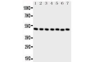 Western Blotting (WB) image for anti-C-terminal Binding Protein 2 (CTBP2) (AA 429-445), (C-Term) antibody (ABIN3044439) (CTBP2 抗体  (C-Term))