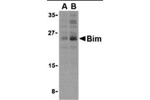 Western Blotting (WB) image for anti-BCL2-Like 11 (Apoptosis Facilitator) (BCL2L11) (Middle Region 2) antibody (ABIN1031197) (BIM 抗体  (Middle Region 2))