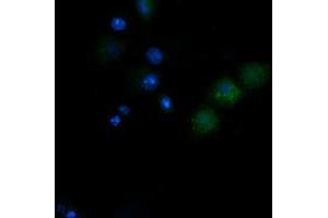Image no. 2 for anti-NADH Dehydrogenase (Ubiquinone) 1 beta Subcomplex, 10, 22kDa (NDUFB10) antibody (ABIN1499671)