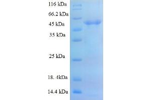 SDS-PAGE (SDS) image for ADAM Metallopeptidase with Thrombospondin Type 1 Motif, 7 (ADAMTS7) (AA 242-593), (partial) protein (His-SUMO Tag) (ABIN5711957)