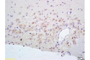 Formalin-fixed and paraffin embedded rat brain labeled with Rabbit Anti NR2A/NMDAR2A Polyclonal Antibody, Unconjugated (ABIN747353) at 1:200 followed by conjugation to the secondary antibody and DAB staining (NMDAR2A 抗体  (AA 851-950))
