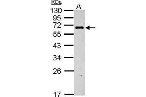 WB Image Sample (30 ug of whole cell lysate) A: BCL-1 12% SDS PAGE antibody diluted at 1:1000 (C4BPB 抗体)