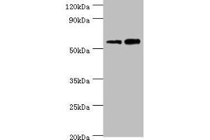 Western blot All lanes: Non-syndromic hearing impairment protein 5 antibody at 10 μg/mL Lane 1: Hela whole cell lysate Lane 2: HepG2 whole cell lysate Secondary Goat polyclonal to rabbit IgG at 1/10000 dilution Predicted band size: 55, 11, 37 kDa Observed band size: 55 kDa (Non-Syndromic Hearing Impairment Protein 5 (GSDME) (AA 1-260) 抗体)