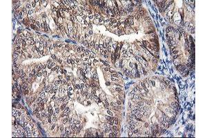 Image no. 10 for anti-F-Box Protein 21 (FBXO21) antibody (ABIN1498232) (FBXO21 抗体)