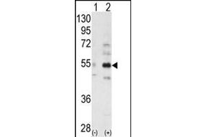 Western blot analysis of ALS2CR2 (arrow) using ALS2CR2 Antibody (C-term ) (ABIN391172 and ABIN2841272). (STRADB 抗体  (C-Term))