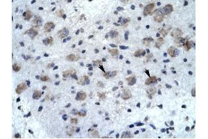 KCNH5 antibody was used for immunohistochemistry at a concentration of 4-8 ug/ml to stain Neural cells (arrows) in Human Brain.