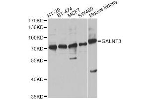 Western blot analysis of extracts of various cell lines, using GALNT3 antibody. (GALNT3 抗体)