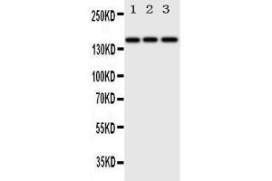 Anti-ErbB 4 antibody, Western blotting Lane 1: HELA Cell Lysate Lane 2: U87 Cell Lysate Lane 3: NEURO Cell Lysate (ERBB4 抗体  (N-Term))
