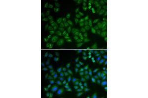 Immunofluorescence analysis of HeLa cells using SMPD1 antibody (ABIN5974079). (SMPD1 抗体)
