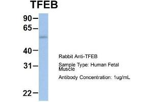 Host: Rabbit  Target Name: TFEB  Sample Tissue: Human Fetal Muscle  Antibody Dilution: 1. (TFEB 抗体  (Middle Region))