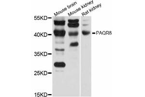 Western blot analysis of extracts of various cell lines, using PAQR8 antibody (ABIN6293387) at 1:1000 dilution. (PAQR8 抗体)