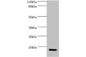 Western blot All lanes: JPT1 antibody at 2 μg/mL + Rat gonad tissue Secondary Goat polyclonal to rabbit IgG at 1/10000 dilution Predicted band size: 17, 20, 12 kDa Observed band size: 17 kDa (JPT1 抗体  (AA 2-154))