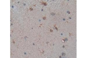 Immunohistochemistry (IHC) image for anti-Solute Carrier Family 6 (Neurotransmitter Transporter, Dopamine), Member 3 (SLC6A3) (AA 562-619) antibody (ABIN1867519)