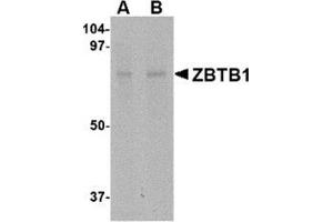 Western blot analysis of ZBTB1 in HepG2 lysate with this product at (A) 1 and (B) 2 μg/ml. (ZBTB1 抗体  (Center))