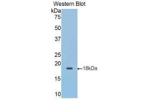 Western Blotting (WB) image for anti-Hexokinase 1 (HK1) (AA 413-540) antibody (ABIN1859174) (Hexokinase 1 抗体  (AA 413-540))