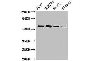 WB analysis of A549 whole cell lysates, HEK293 whole cell lysates, HepG2 whole cell lysates, and Rat Kidney tissue, using P4HA1 antibody (2. (P4HA1 抗体  (AA 256-525))