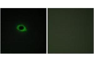 Immunofluorescence analysis of COS7 cells, using TENS3 Antibody. (TNS3 抗体  (AA 541-590))