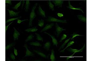 Immunofluorescence of monoclonal antibody to PER2 on HeLa cell. (PER2 抗体  (AA 1-100))