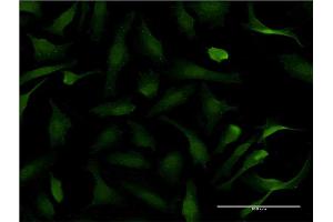 Immunofluorescence of monoclonal antibody to PER2 on HeLa cell. (PER2 抗体  (AA 1-100))