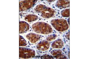 CPSF3L Antibody immunohistochemistry analysis in formalin fixed and paraffin embedded human stomach tissue followed by peroxidase conjugation of the secondary antibody and DAB staining. (CPSF3L 抗体  (N-Term))