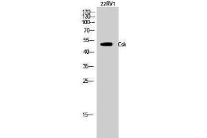 Western Blotting (WB) image for anti-C-Src tyrosine Kinase (CSK) (Ser280) antibody (ABIN3184105) (CSK 抗体  (Ser280))