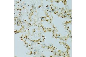 Immunohistochemistry of paraffin-embedded rat lung using RCC1 antibody (ABIN5973761) at dilution of 1/100 (40x lens). (RCC1 抗体)