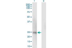 Western Blot analysis of SSU72 expression in transfected 293T cell line by SSU72 MaxPab polyclonal antibody. (SSU72 抗体  (AA 1-194))