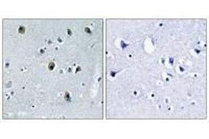 Immunohistochemistry (IHC) image for anti-Collagen, Type II, alpha 1 (COL2A1) (C-Term) antibody (ABIN7180145)