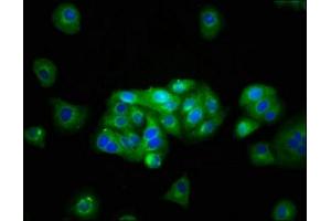 Immunofluorescence staining of HepG2 cells with ABIN7145017 at 1:133, counter-stained with DAPI. (KCNJ1 抗体  (AA 165-379))