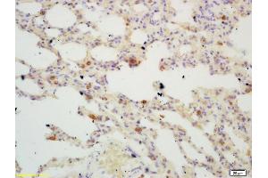 Formalin-fixed and paraffin embedded mouse lung labeled with Rabbit Anti TIGAR Polyclonal Antibody, Unconjugated (ABIN671286) at 1:200 followed by conjugation to the secondary antibody and DAB staining (TIGAR 抗体  (AA 161-270))